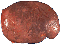 healthy spleen